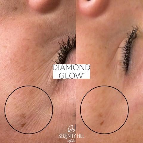 Diamond Glow Facial 2 (2)