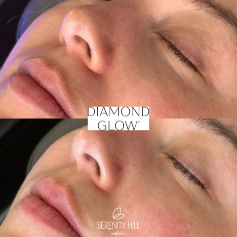 Diamond Glow Facial 4 (1)